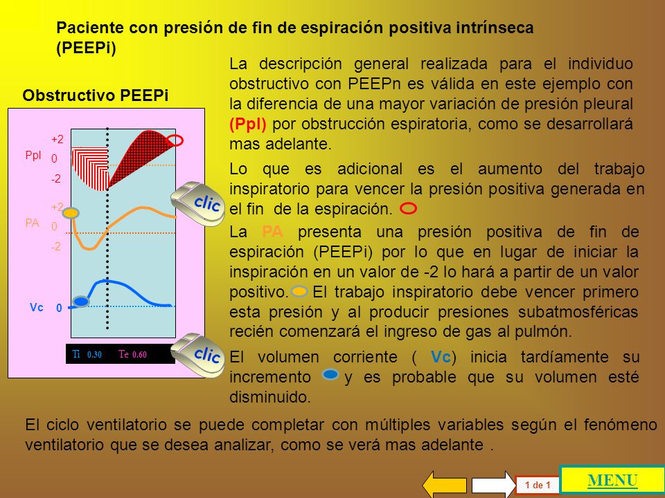 Paciente con presión de fin de espiración positiva intrínseca (PEEPi)