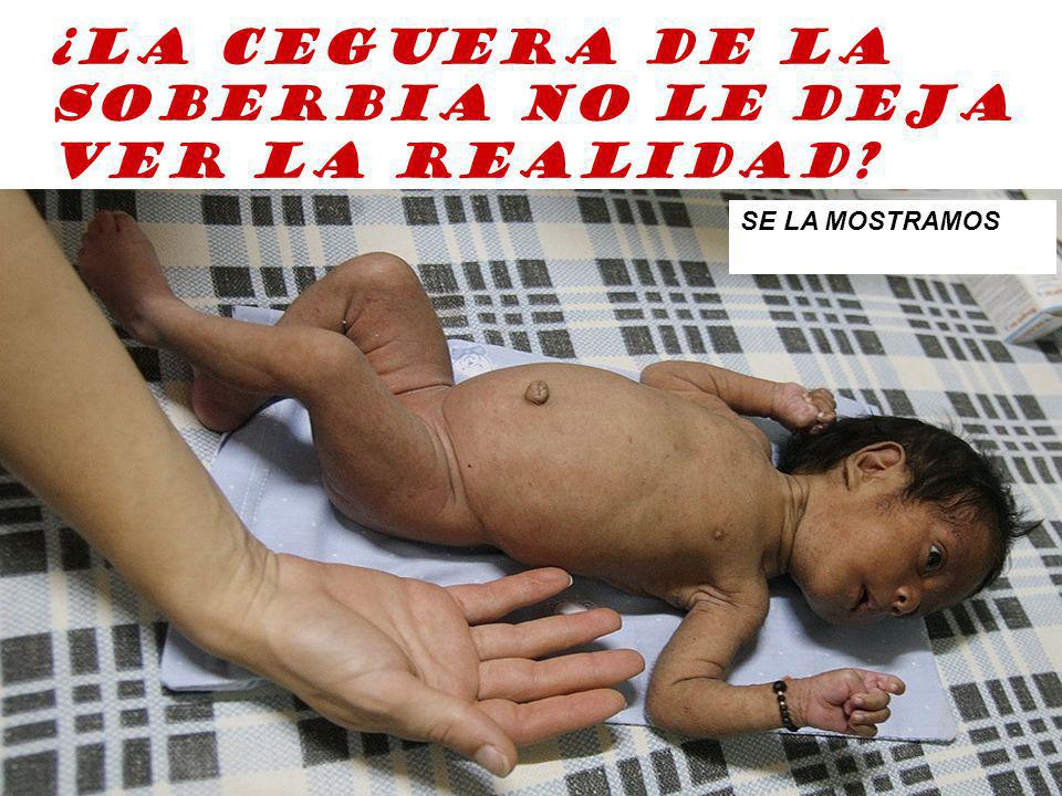 ¿LA CEGUERA DE LA SOBERBIA NO LE DEJA VER LA REALIDAD SE LA MOSTRAMOS