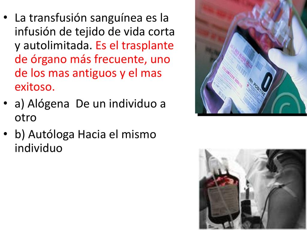 La transfusión sanguínea es la infusión de tejido de vida corta y autolimitada. Es el trasplante de órgano más frecuente, uno de los mas antiguos y el mas exitoso.