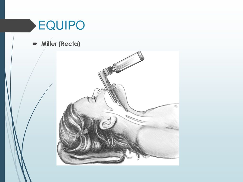 EQUIPO Miller (Recta) Punta de la hoja levanta la epiglotis directamente