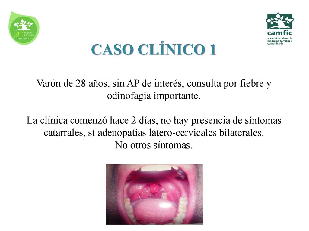 CASO CLÍNICO 1 Varón de 28 años, sin AP de interés, consulta por fiebre y odinofagia importante.