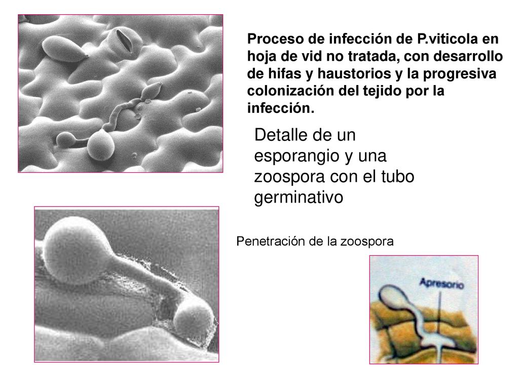 Detalle de un esporangio y una zoospora con el tubo germinativo