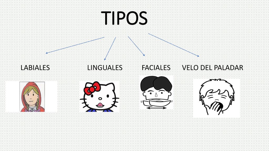 TIPOS LABIALES LINGUALES FACIALES VELO DEL PALADAR