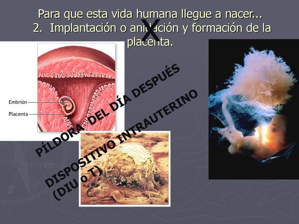 x Para que esta vida humana llegue a nacer Implantación o anidación y formación de la placenta.