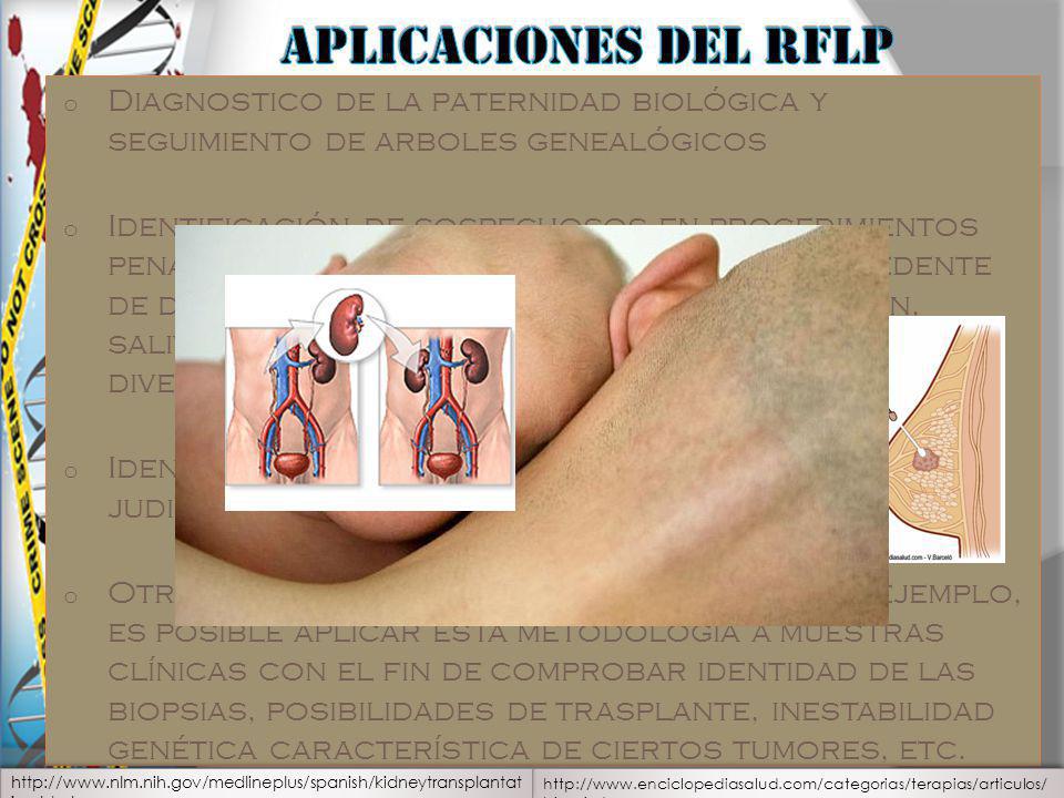 Aplicaciones del RFLP Diagnostico de la paternidad biológica y seguimiento de arboles genealógicos.
