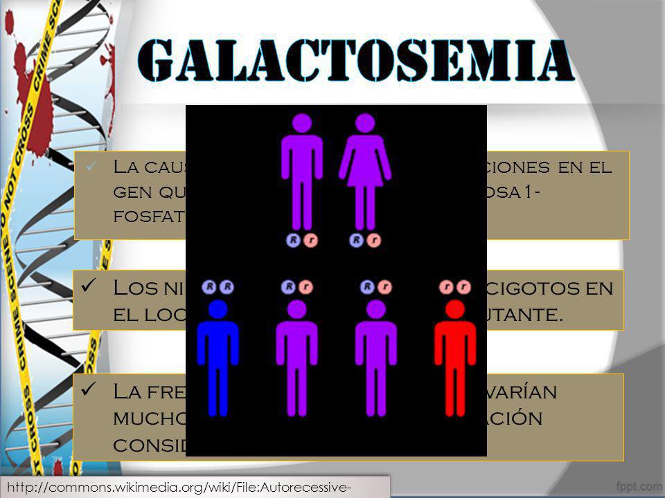 Galactosemia La causa mas frecuente son mutaciones en el gen que codifica la enzima galactosa1-fosfato uridiltrasferasa (GALT).