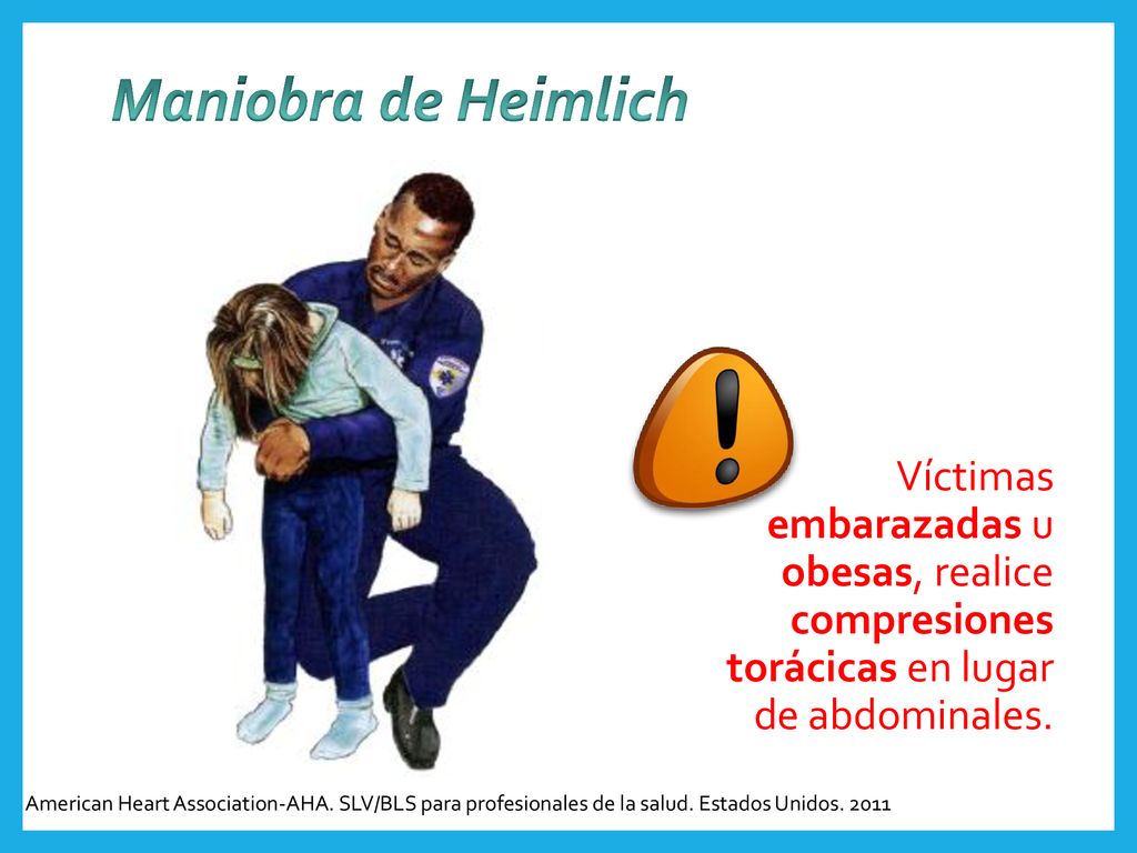 Maniobra de Heimlich Víctimas embarazadas u obesas, realice compresiones torácicas en lugar de abdominales.