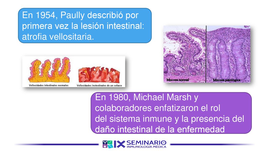 En 1954, Paully describió por primera vez la lesión intestinal: atrofia vellositaria.