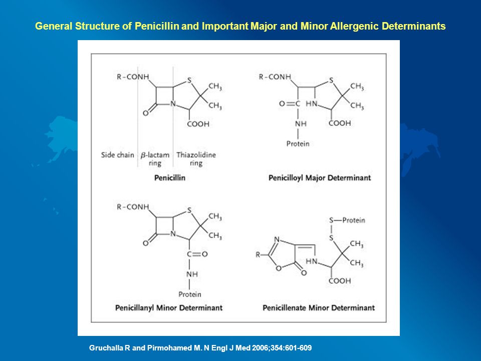 General Structure of Penicillin and Important Major and Minor Allergenic Determinants