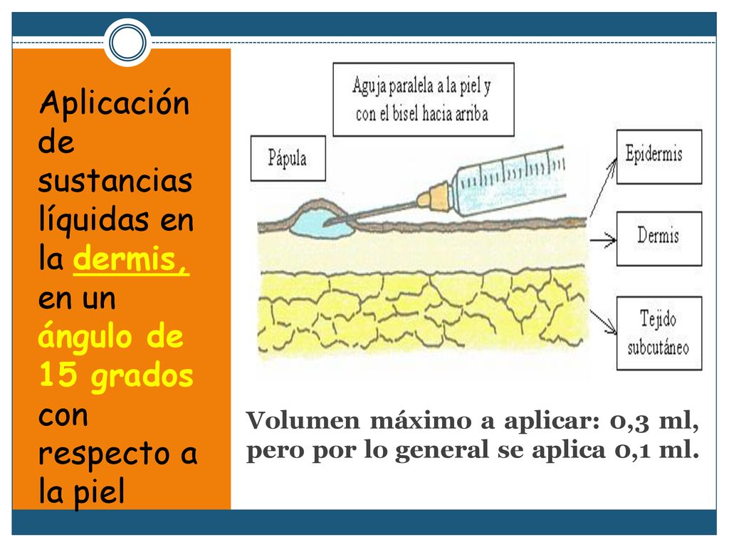 Aplicación de sustancias líquidas en la dermis, en un ángulo de 15 grados con respecto a la piel