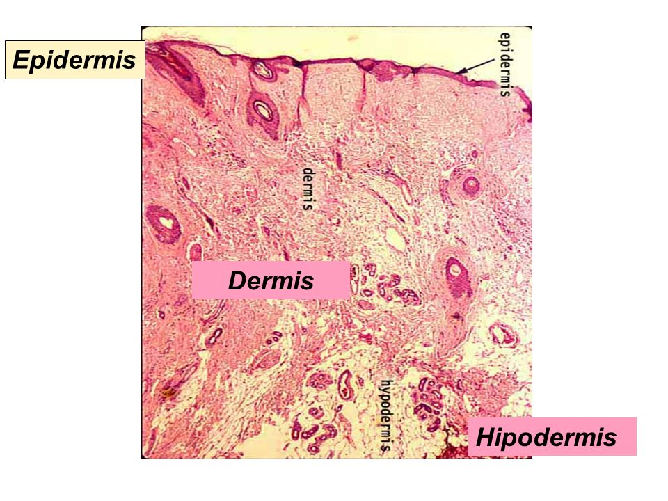 Epidermis Dermis Hipodermis