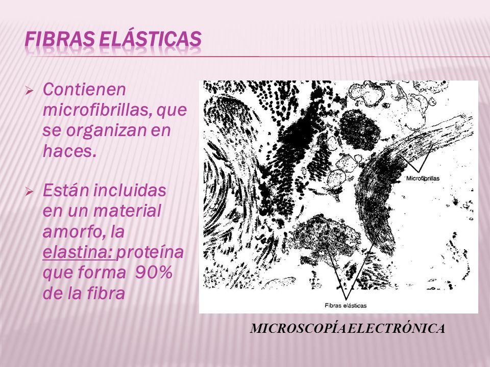 Fibras elásticas Contienen microfibrillas, que se organizan en haces.