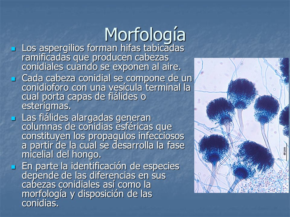 Morfología Los aspergilios forman hifas tabicadas ramificadas que producen cabezas conidiales cuando se exponen al aire.