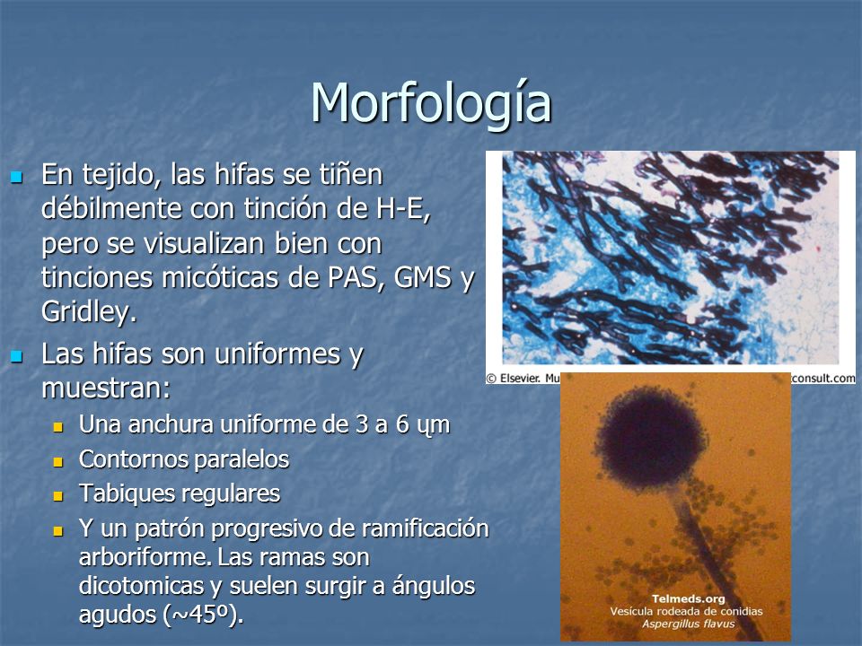 Morfología En tejido, las hifas se tiñen débilmente con tinción de H-E, pero se visualizan bien con tinciones micóticas de PAS, GMS y Gridley.