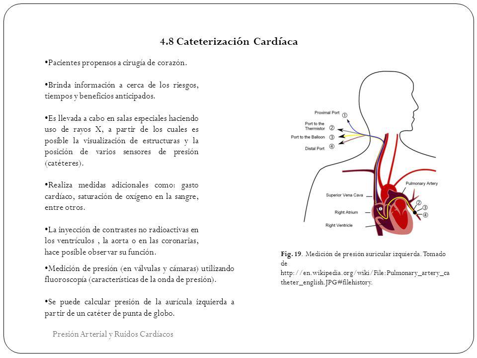 4.8 Cateterización Cardíaca