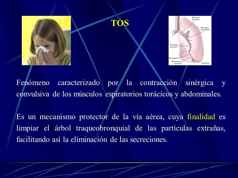 TOS Fenómeno caracterizado por la contracción sinérgica y convulsiva de los músculos espiratorios torácicos y abdominales.
