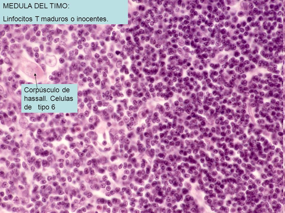 MEDULA DEL TIMO: Linfocitos T maduros o inocentes. Corpúsculo de hassall. Celulas de tipo 6