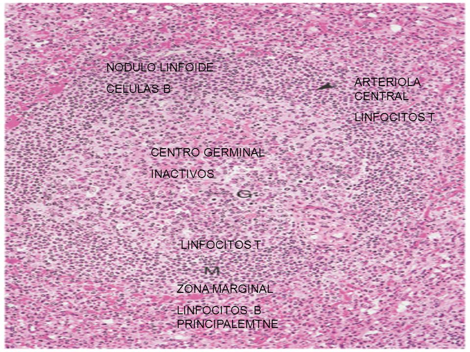 NODULO LINFOIDE CELULAS B. ARTERIOLA CENTRAL. LINFOCITOS T. CENTRO GERMINAL. INACTIVOS. LINFOCITOS T.