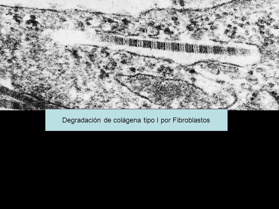 Degradación de colágena tipo I por Fibroblastos
