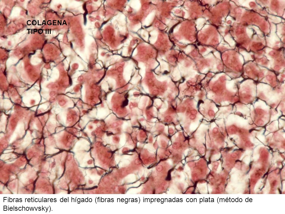 COLAGENA TIPO III Fibras reticulares del hígado (fibras negras) impregnadas con plata (método de Bielschowvsky).