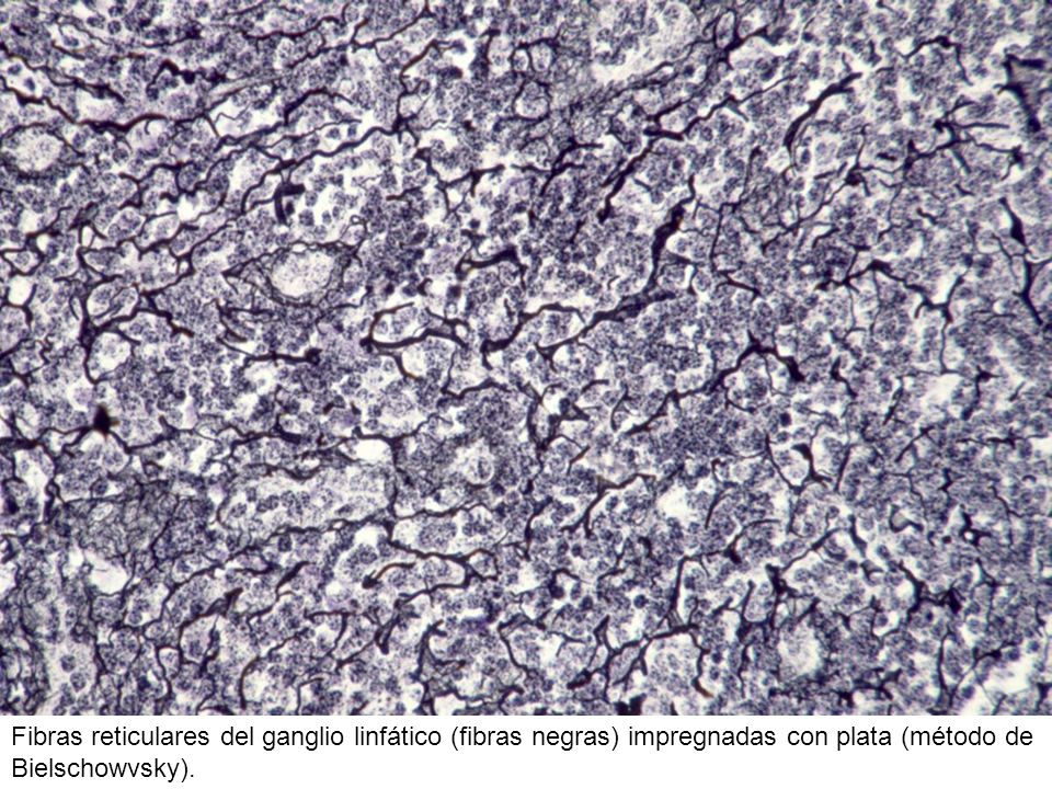 Fibras reticulares del ganglio linfático (fibras negras) impregnadas con plata (método de Bielschowvsky).