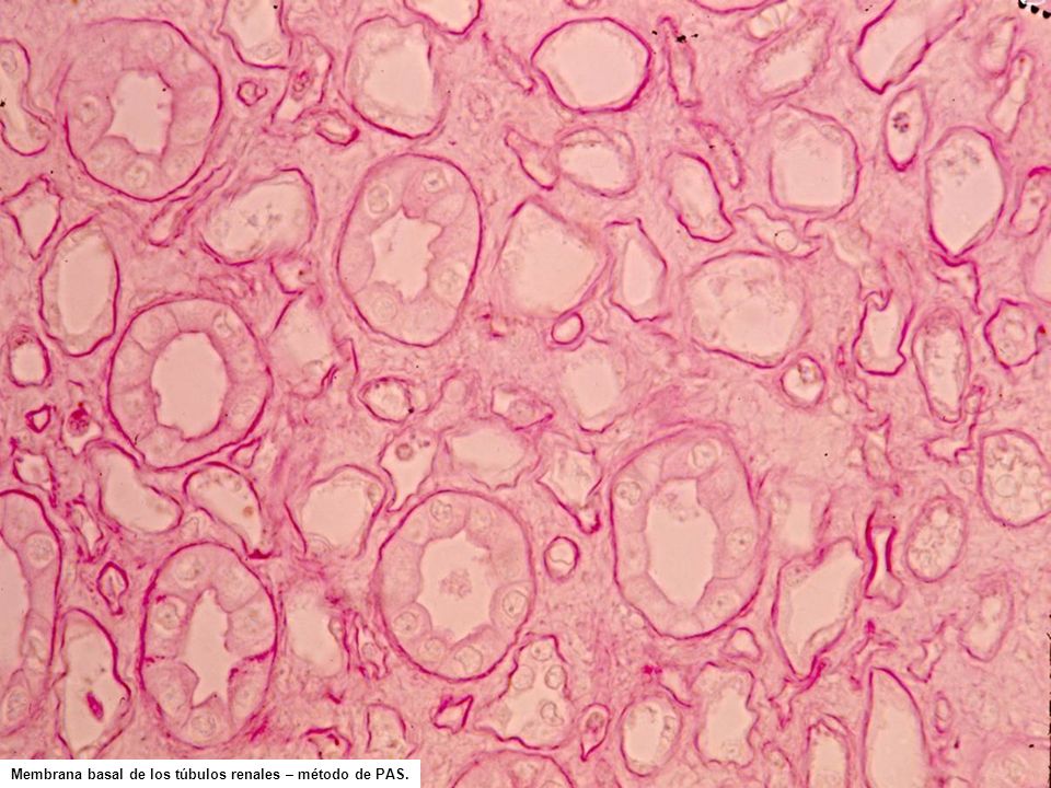 Membrana basal de los túbulos renales – método de PAS.