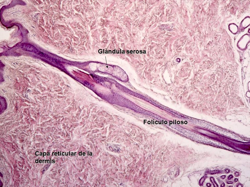 Glándula serosa Folículo piloso Capa reticular de la dermis