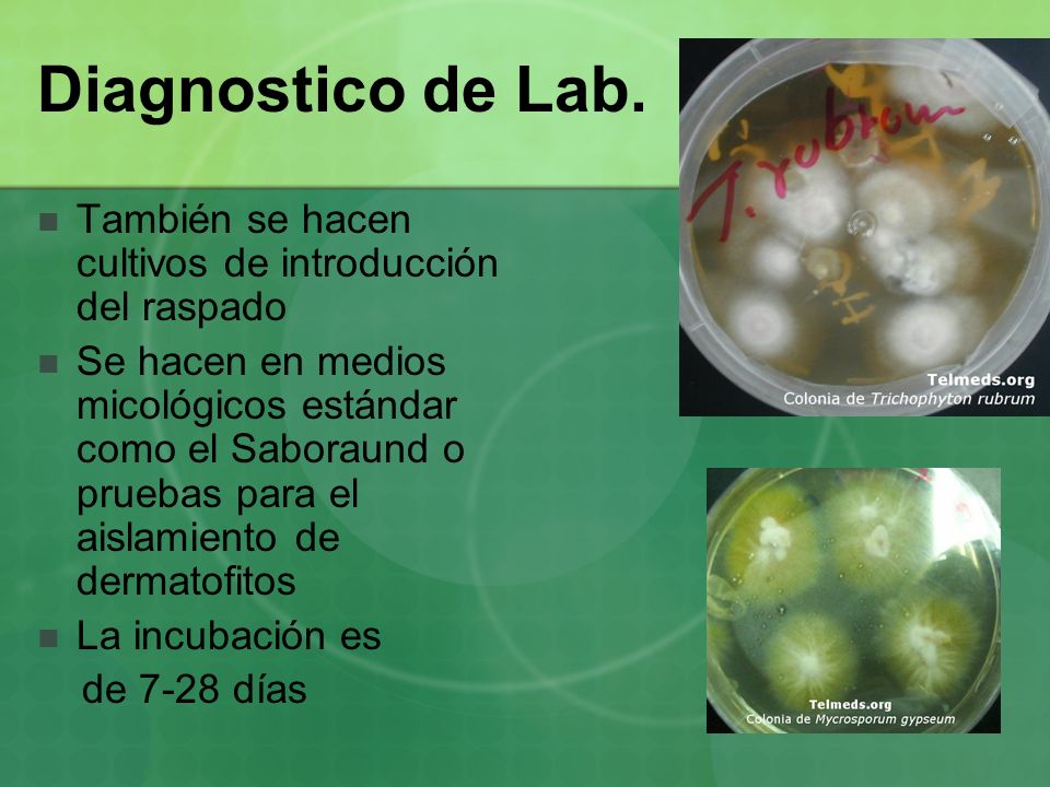 Diagnostico de Lab. También se hacen cultivos de introducción del raspado.
