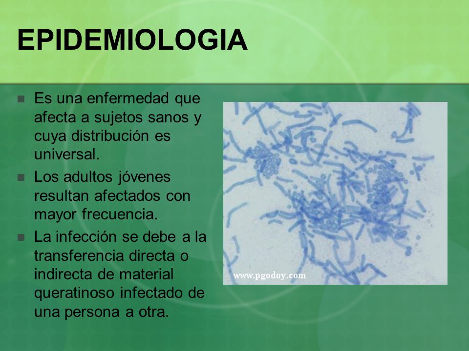 EPIDEMIOLOGIA Es una enfermedad que afecta a sujetos sanos y cuya distribución es universal.