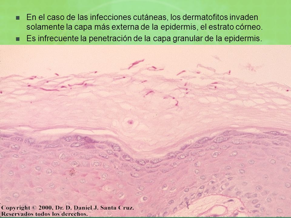 En el caso de las infecciones cutáneas, los dermatofitos invaden solamente la capa más externa de la epidermis, el estrato córneo.