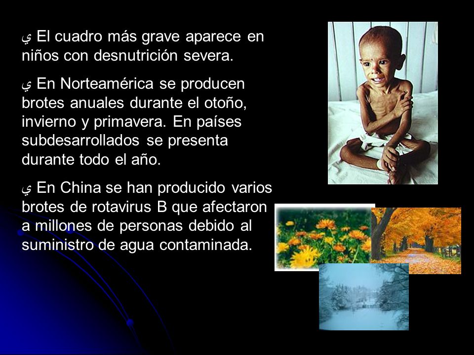El cuadro más grave aparece en niños con desnutrición severa.