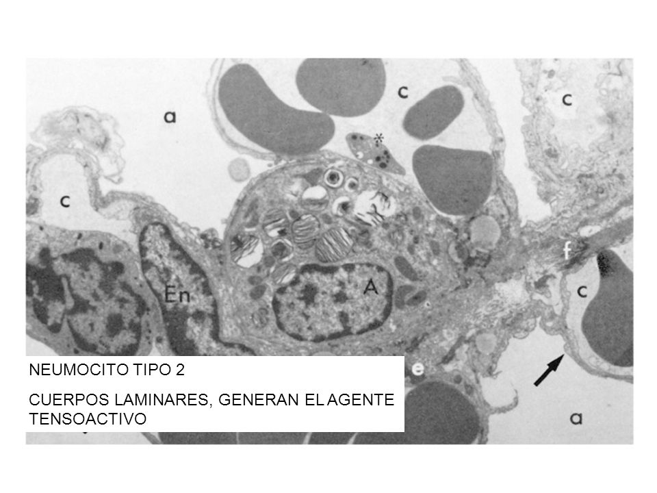 NEUMOCITO TIPO 2 CUERPOS LAMINARES, GENERAN EL AGENTE TENSOACTIVO