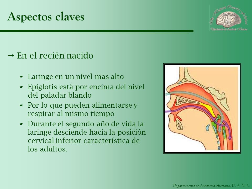 Aspectos claves En el recién nacido Laringe en un nivel mas alto