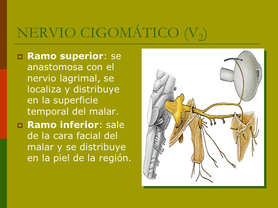 NERVIO CIGOMÁTICO (V2) Ramo superior: se anastomosa con el nervio lagrimal, se localiza y distribuye en la superficie temporal del malar.