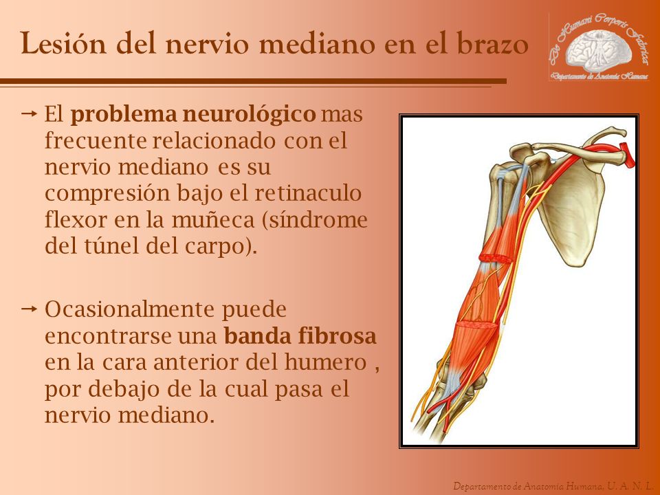 Lesión del nervio mediano en el brazo