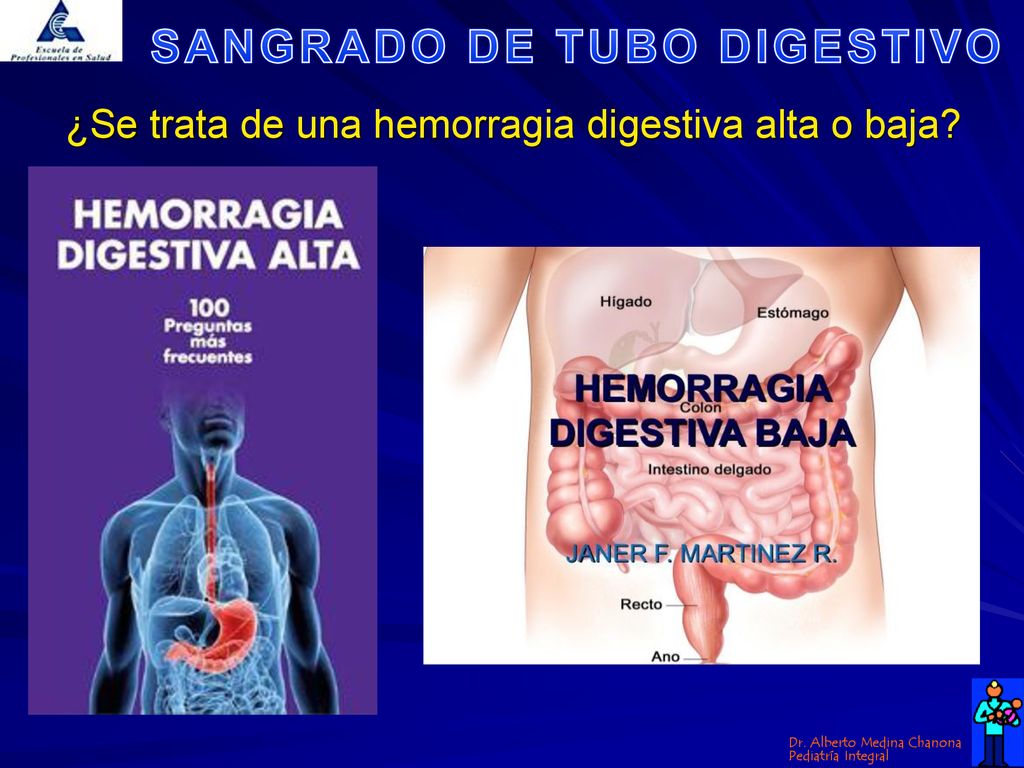 ¿Se trata de una hemorragia digestiva alta o baja