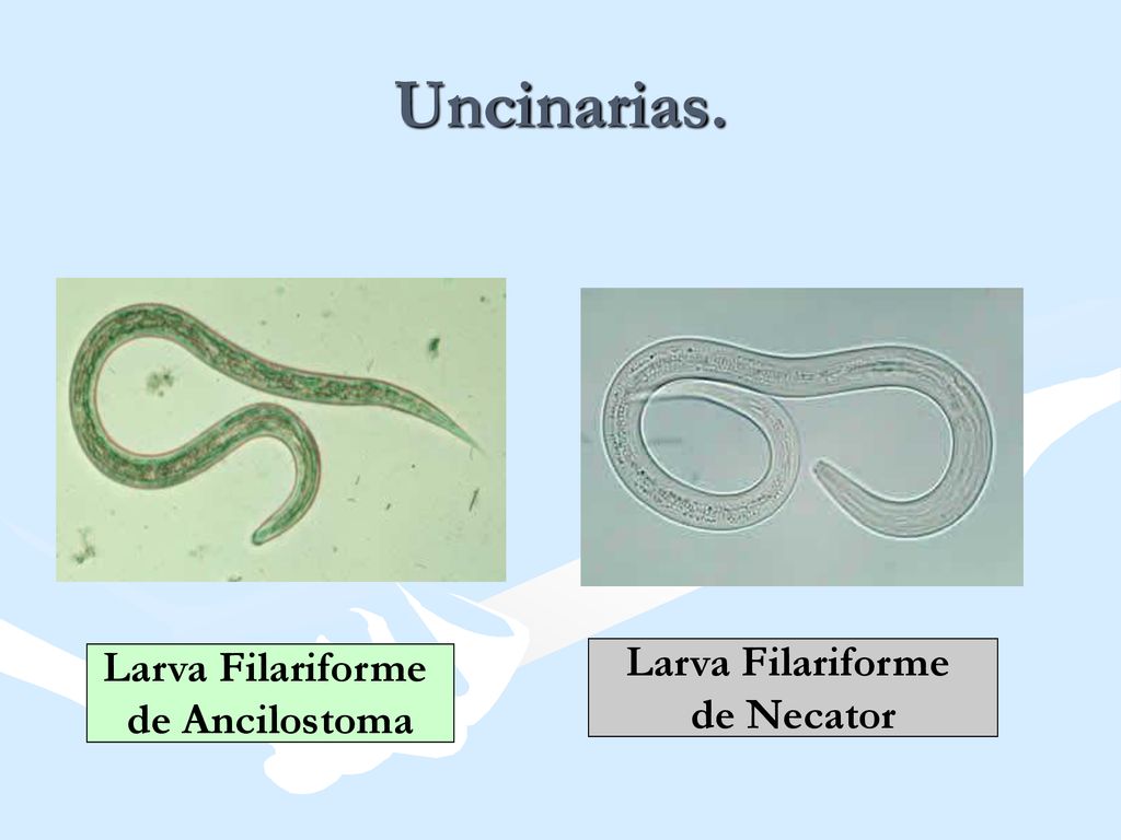 Uncinarias. Larva Filariforme Larva Filariforme de Necator