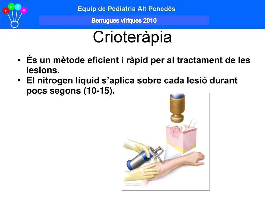 Berrugues víriques 2010 Crioteràpia. És un mètode eficient i ràpid per al tractament de les lesions.