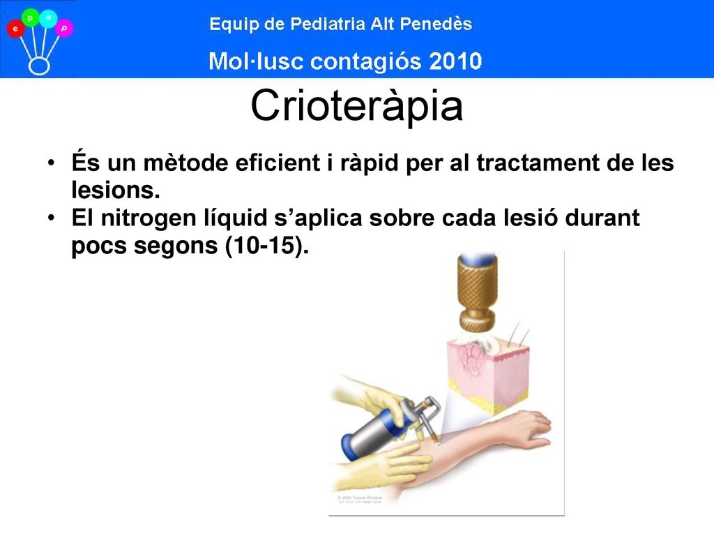 Crioteràpia És un mètode eficient i ràpid per al tractament de les lesions.