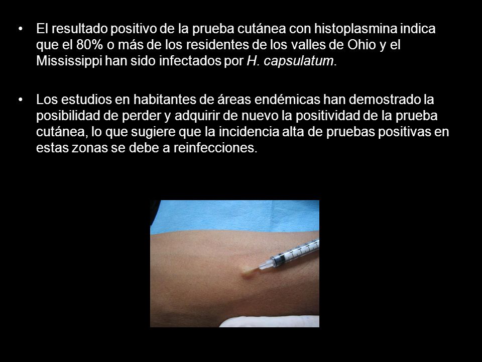 El resultado positivo de la prueba cutánea con histoplasmina indica que el 80% o más de los residentes de los valles de Ohio y el Mississippi han sido infectados por H. capsulatum.