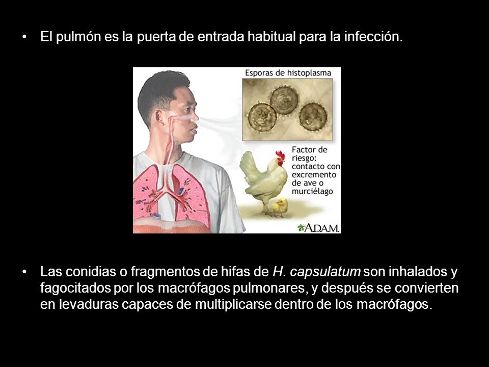 El pulmón es la puerta de entrada habitual para la infección.