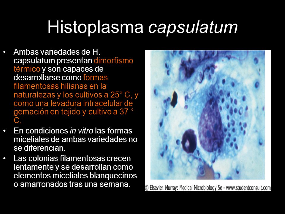 Histoplasma capsulatum