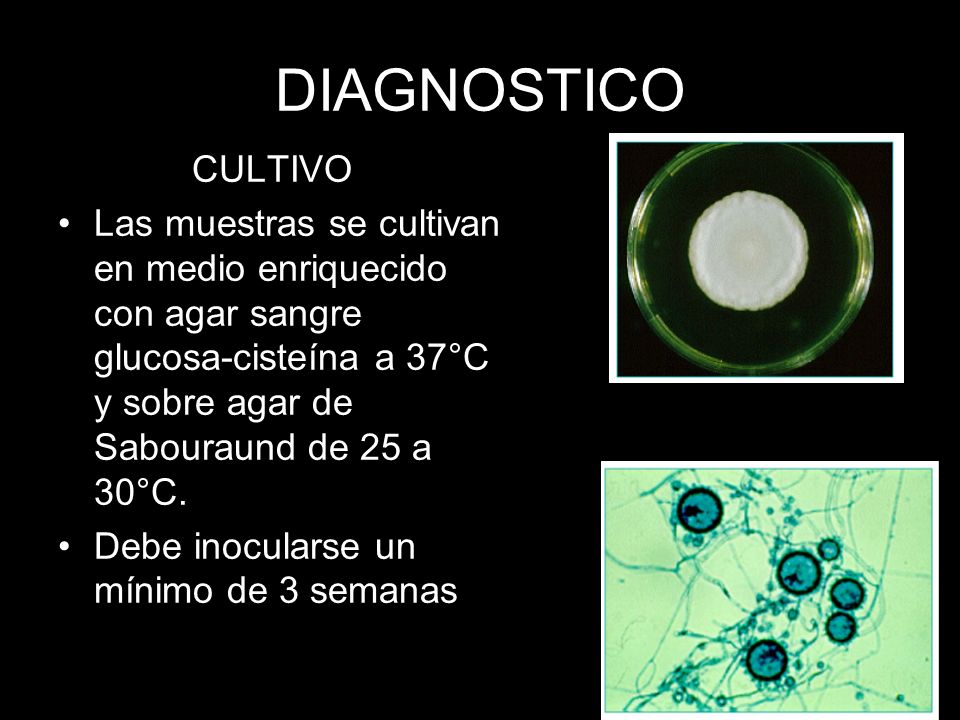 DIAGNOSTICO CULTIVO. Las muestras se cultivan en medio enriquecido con agar sangre glucosa-cisteína a 37°C y sobre agar de Sabouraund de 25 a 30°C.