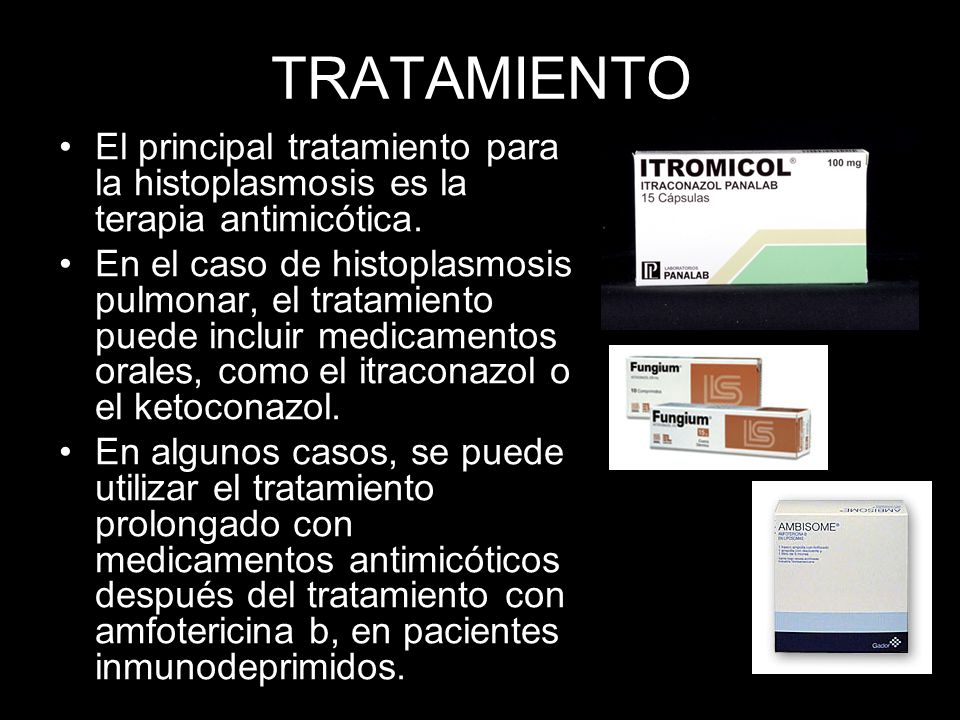 TRATAMIENTO El principal tratamiento para la histoplasmosis es la terapia antimicótica.