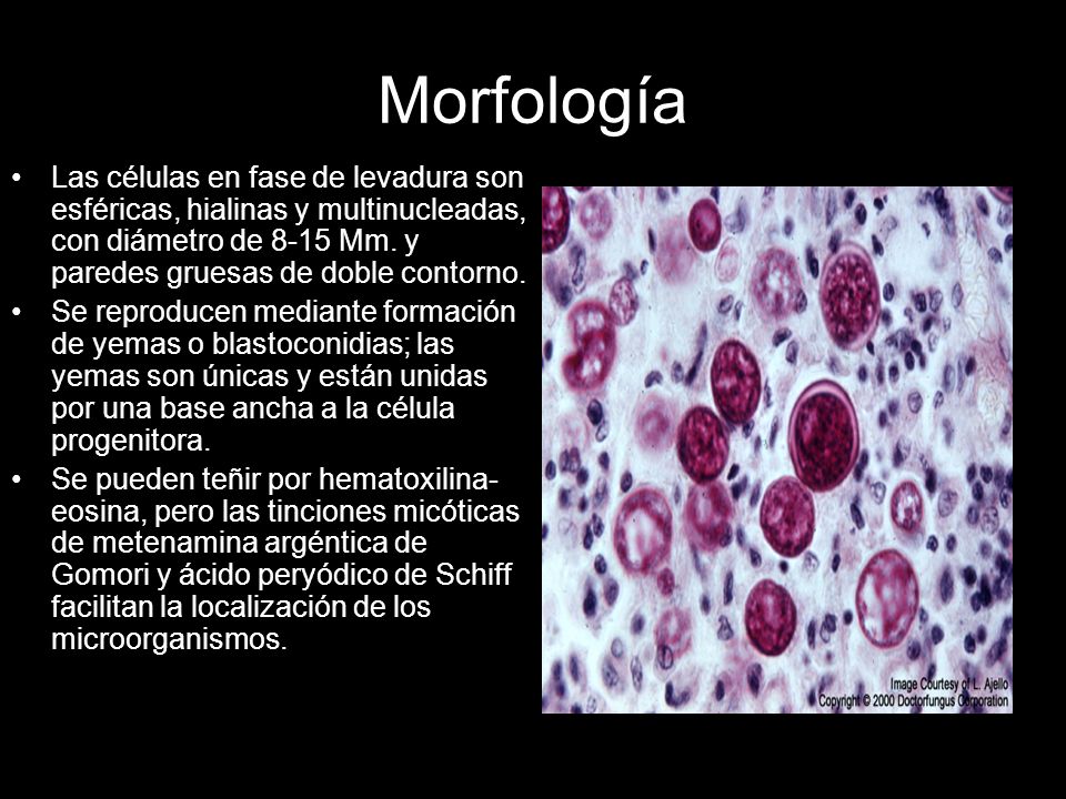 Morfología Las células en fase de levadura son esféricas, hialinas y multinucleadas, con diámetro de 8-15 Mm. y paredes gruesas de doble contorno.