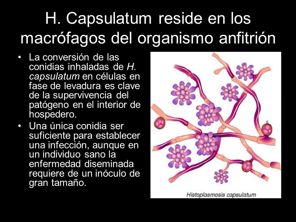 H. Capsulatum reside en los macrófagos del organismo anfitrión