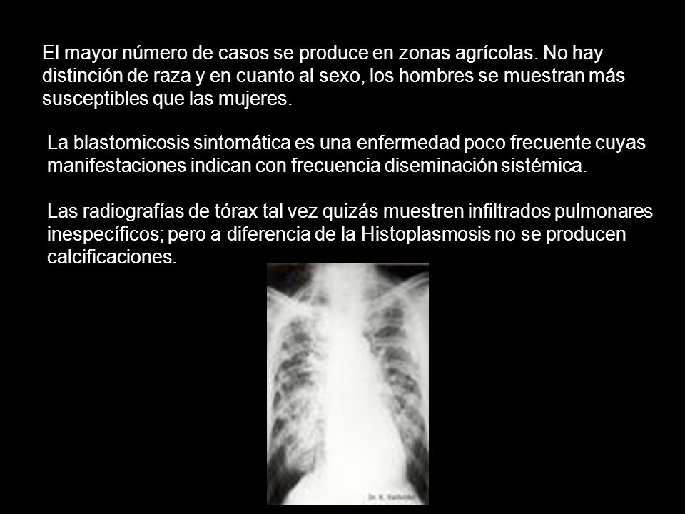 El mayor número de casos se produce en zonas agrícolas