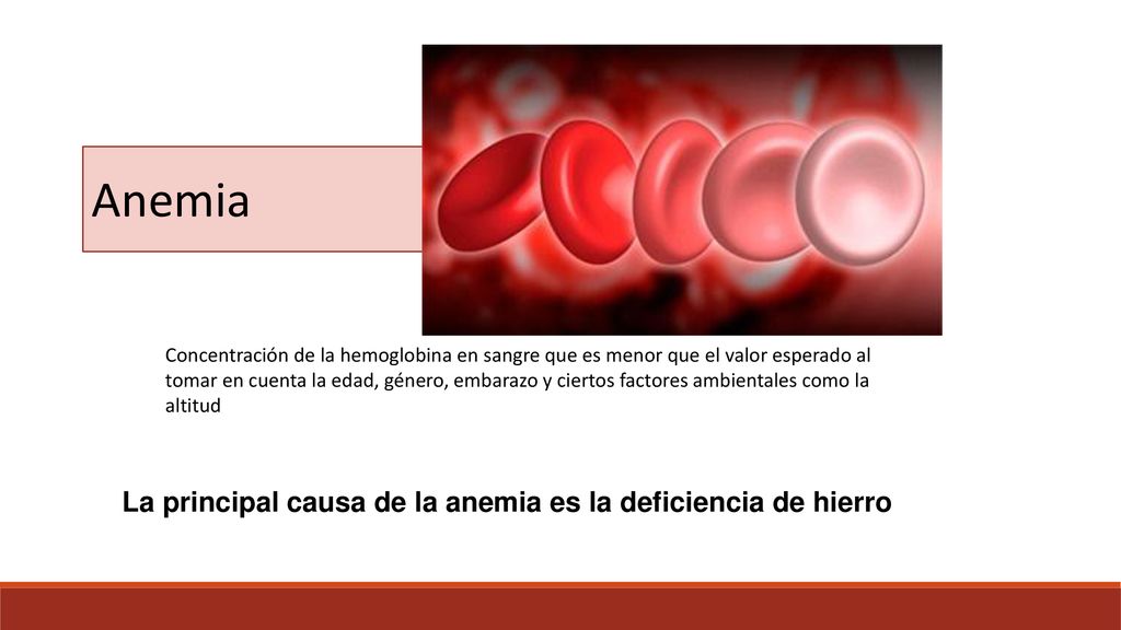 Anemia La principal causa de la anemia es la deficiencia de hierro