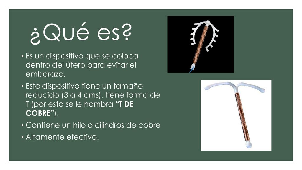¿Qué es Es un dispositivo que se coloca dentro del útero para evitar el embarazo.