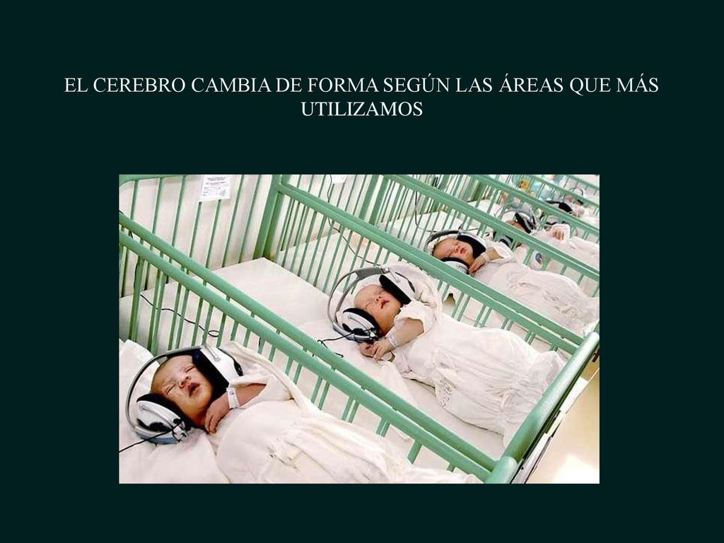 EL CEREBRO CAMBIA DE FORMA SEGÚN LAS ÁREAS QUE MÁS UTILIZAMOS